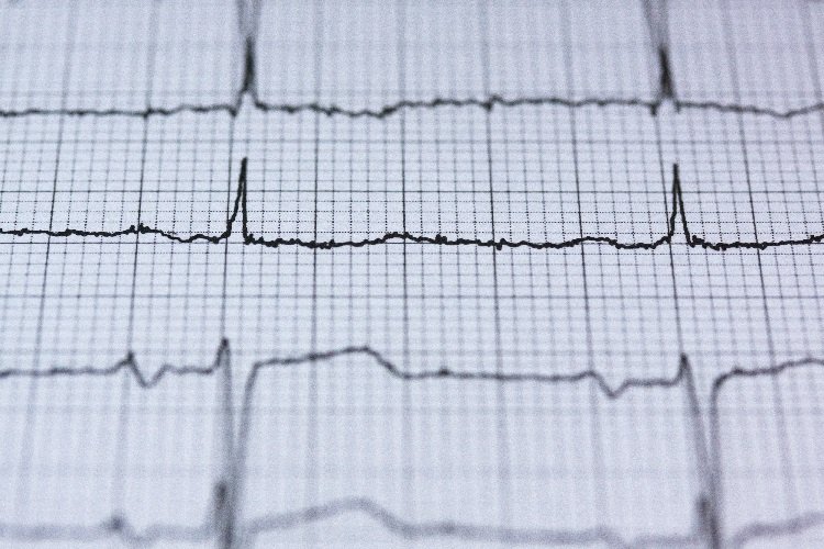 5 Fakta Menarik Pengobatan Penyakit Jantung dengan Formula Ibnu Sina
